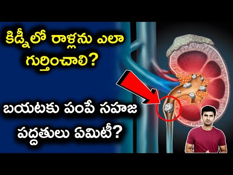  Kidney Stones Symptoms And Natural Remedies To Cure At Home |telugu Facts |-TeluguStop.com
