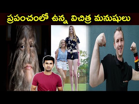  Why Capsule Has Two Different Colours?|telugu Facts-TeluguStop.com