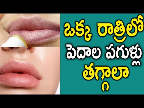  Home Remedies For Chapped Lips-TeluguStop.com