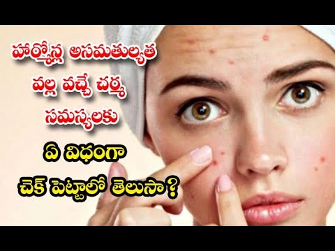  Do You Know How To Check For Skin Problems Caused By Hormona-TeluguStop.com