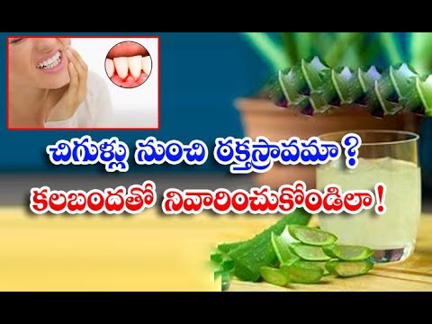  Home Remedies Health #aloevera #ble-TeluguStop.com