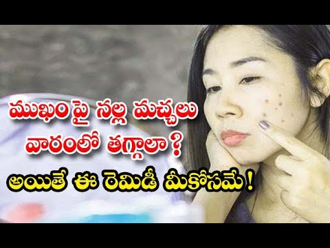  Effective Home Remedy To Remove Dark Spots On Face Home Remedy-TeluguStop.com
