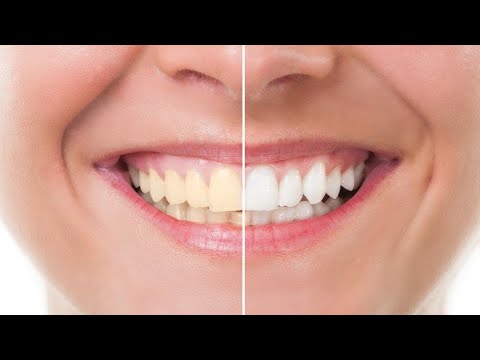  Effective Home Remedy For Teeth Whitening Effective Home Remedy-TeluguStop.com