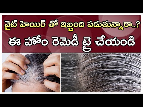 Home Remedies For White Hair-TeluguStop.com
