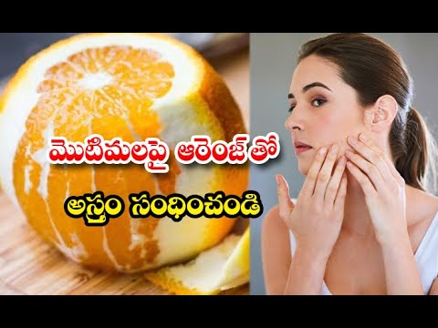  Look How Orange Fights With Pimples Details-TeluguStop.com