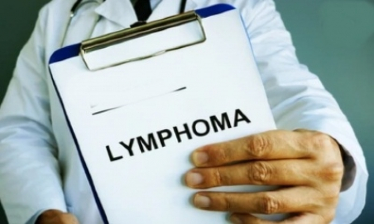  Early Diagnosis Key To Cure Lymphoma: Doctors-TeluguStop.com