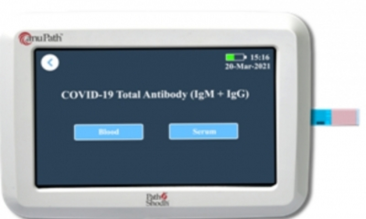  Electrochemical Elisa: Novel Test For Total Covid Antibody Concentration-TeluguStop.com