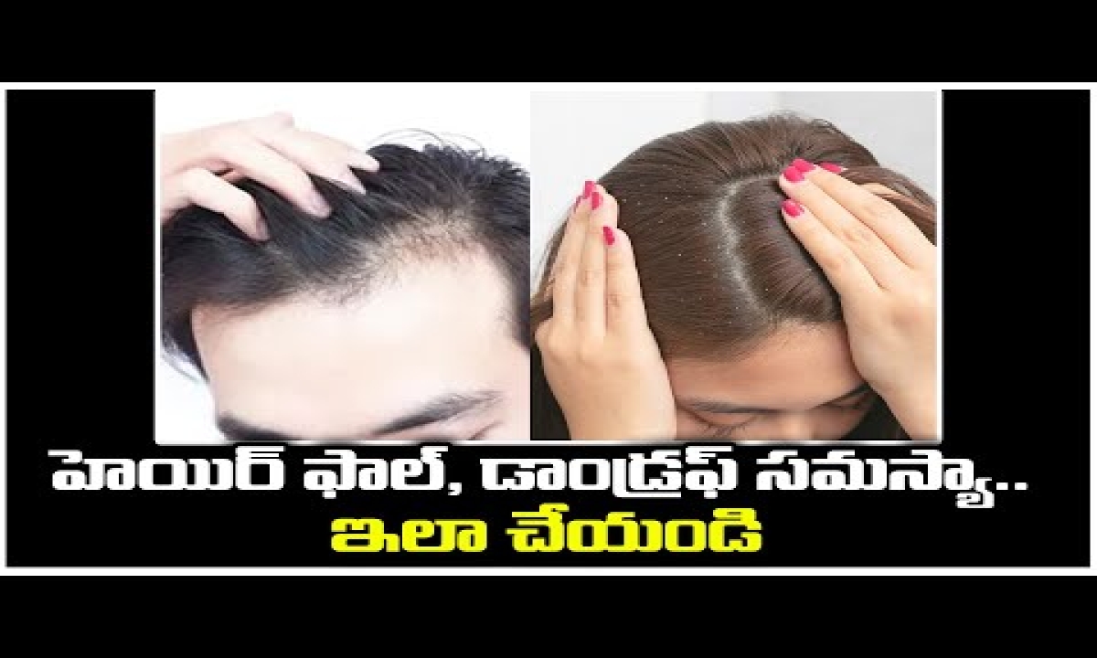 Home Remedies to Get Rid of Hair fall and Dandruff - Dandruff, Telugu,  Telugustop | Home Remedies To Get Rid Of Hair Fall And Dandruff - Dandruff,  Telugu, Telugustop