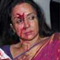  Car Crash: Dream Girl Injured Seriously-TeluguStop.com