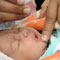  Polio Scare In Hyderabad! Not To Be Worried!-TeluguStop.com