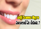  Super Home Remedies For Yellow Teeth-TeluguStop.com