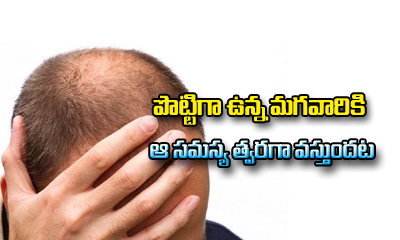  Short Men Bald Early Than Long Men – Study-TeluguStop.com