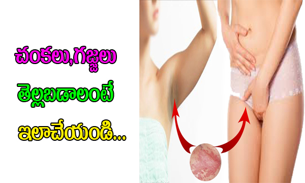  Dark Knees And Dark Elbows By Simple Beauty Secrets-TeluguStop.com