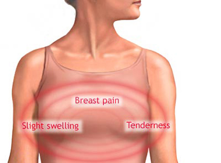 Why do women breasts swell and pain at that time ? - Why Do Women Breasts Swell