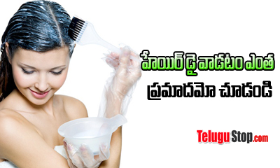  Dangerous Side Effects Of Hair Dye-TeluguStop.com
