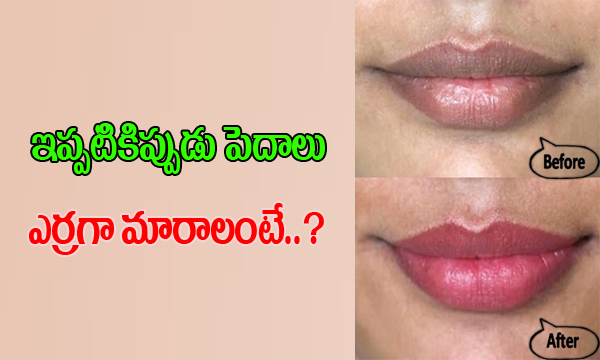  How To Make Your Lips Pink, Soft And Naturally?-TeluguStop.com