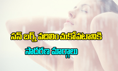  How To Get Rid Of Sunburn Fast-TeluguStop.com