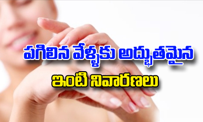  Home Remedies For Cracked Fingers-TeluguStop.com