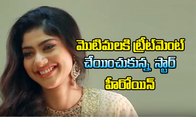  Sai Pallavi Undergone Treatment For Pimples ?-TeluguStop.com