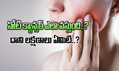  Signs And Symptoms Of Oral Cancer-TeluguStop.com