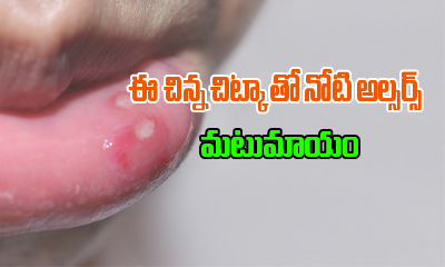  Mouth Ulcers Prevention Treatement-TeluguStop.com