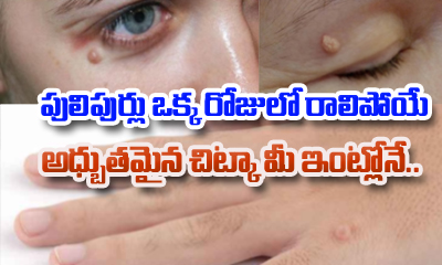  Home Remedies To Get Rid Of Warts-TeluguStop.com