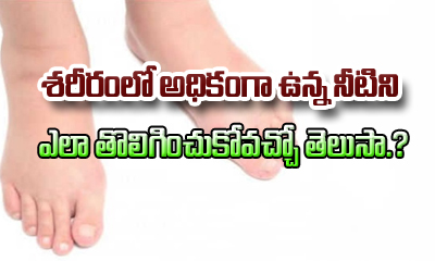  Home Remedies For Water Retention In Body (edema)-TeluguStop.com