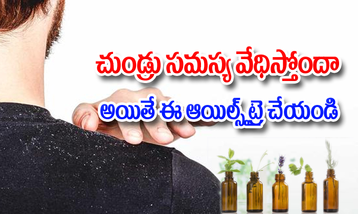  Best Essential Oils For Dandruff-TeluguStop.com