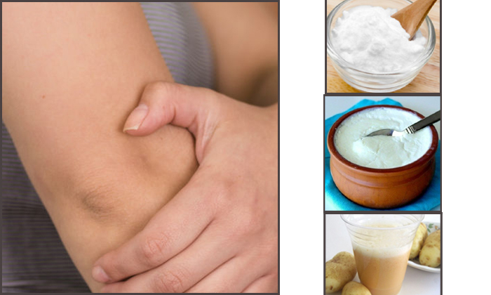  Home Remedies For Dark Elbows 2-TeluguStop.com