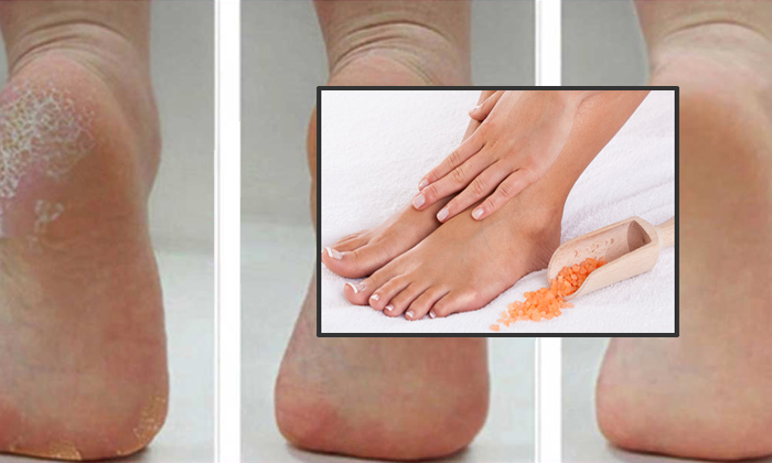  Feet Tan Remove Packs-TeluguStop.com