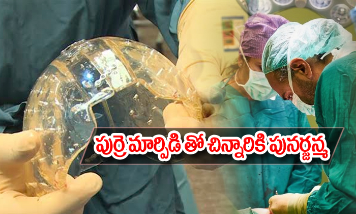  Indias First Skull Implant Surgery Saves Life Of 4 Year Old Pune Girl-TeluguStop.com