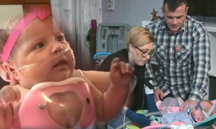  Baby Born With Heart Outside Chest Returns Home-TeluguStop.com