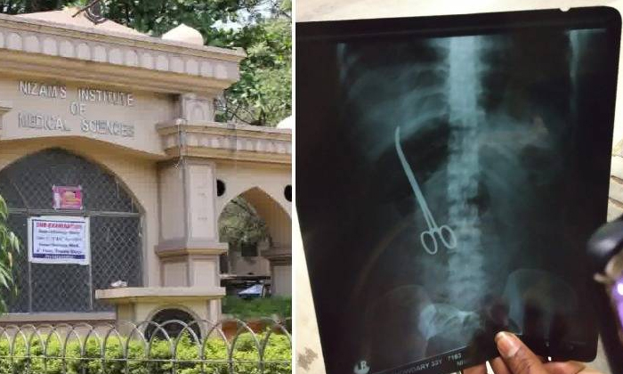  Nims Doctors Forget Scissors Inside Patients Stomach-TeluguStop.com