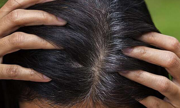  White Hair To Black Hair, Telugu Health, Hair Care Tips-TeluguStop.com