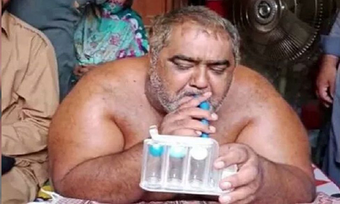  Pakistan Heaviest Man Nooru Hassan Dies Because Of Hospital Negligence-TeluguStop.com