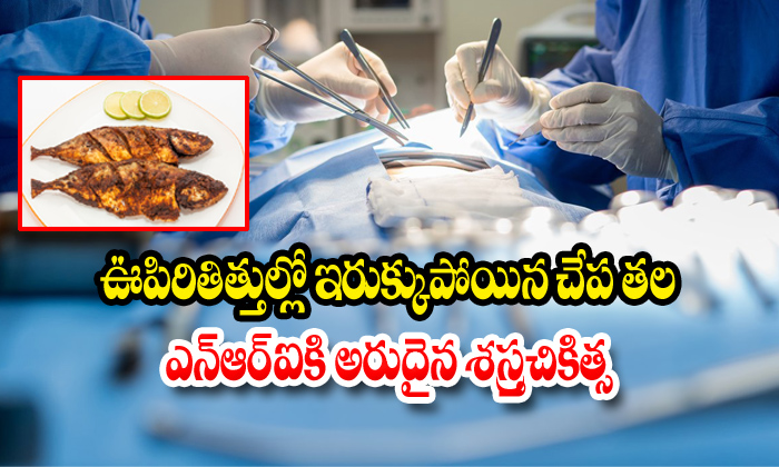  Doctors Remove Portion Of Fish Head Nri Lung In Kochi-TeluguStop.com