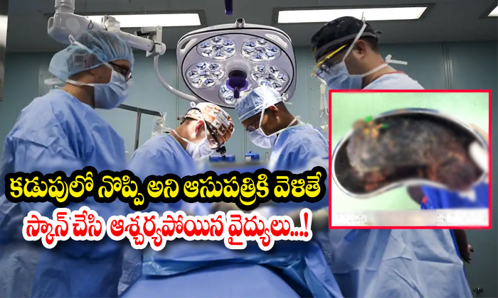  Abdominal Pain,doctors Were Surprised Doctors Were Surprised,hair And Shampoo C-TeluguStop.com
