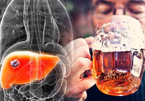 Telugu Alcohol, Benefitsridge, Benefits, Tips, Liver, Ridge Gourd-Telugu Health