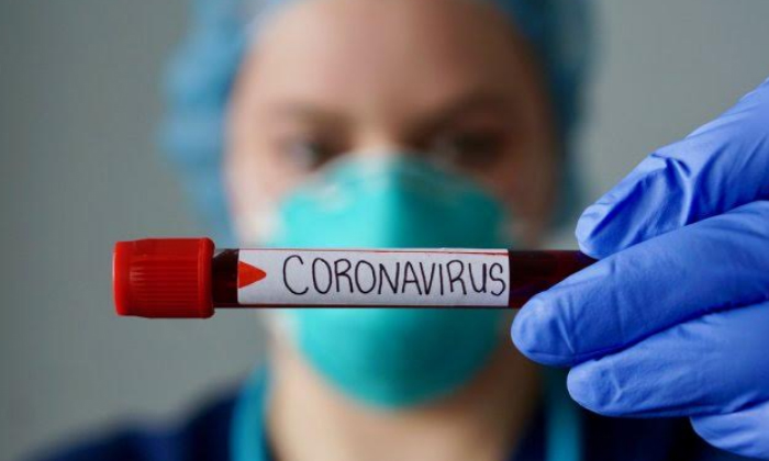  Us Lab Unveils Portable Coronavirus Test That Gives Results Within 5 Minutes, Us-TeluguStop.com