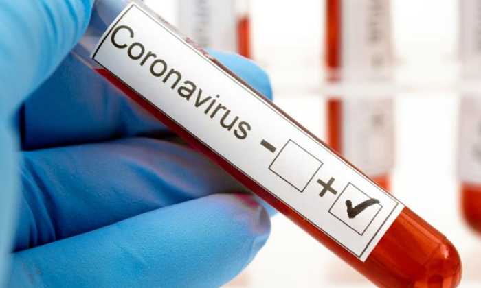Telugu Coronavirus, Covid, Indianamerican, Indian Doctors, Jamaica, Nweyork-