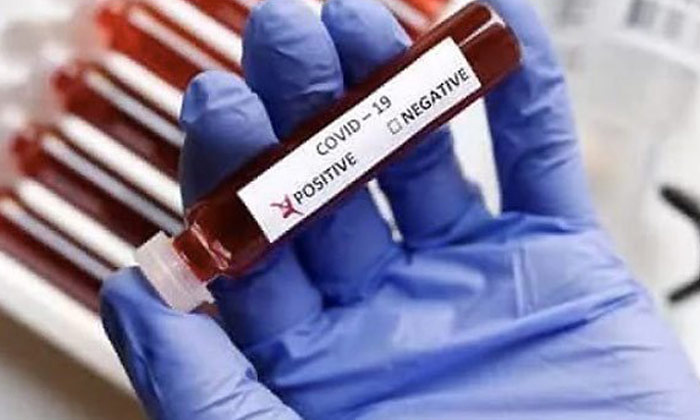  Three Persons Infected With Coronavirus After Cigarette Sharing In Shadnagar , S-TeluguStop.com