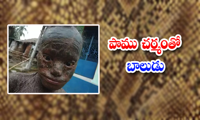  10 Years Old Boy Was With Snake Skin In Odisha, Odisha, Jaganath Snake Skin, Lam-TeluguStop.com