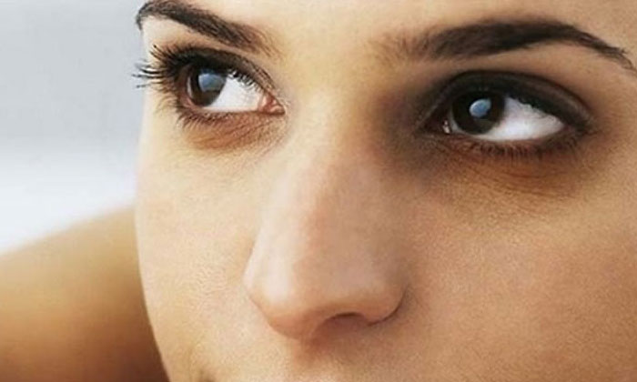  How To Remove Dark Circles Under Eyes Permanently?? Dark Circles, Eyes, Eye Care-TeluguStop.com