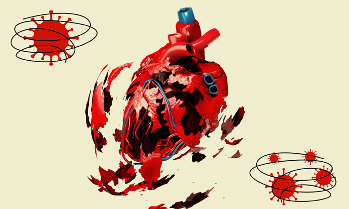  Can Coronavirus Cause Heart Damage?,  Coronavirus,heart Attack, Corona And Heart-TeluguStop.com