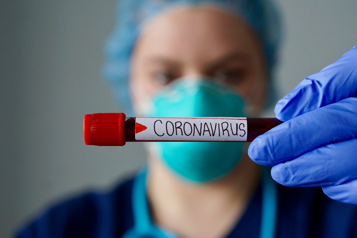  No Symptoms Also Results In Corona Positive,corona Virus, Covid-19 Positive, Cou-TeluguStop.com