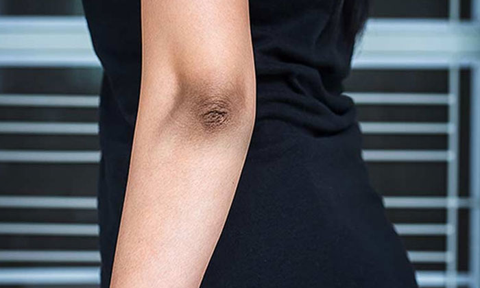  Simple Tips For How To Get Rid Of Black Elbows!! Simple Tips, Black Elbow, Beaut-TeluguStop.com
