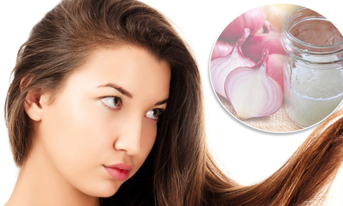  How To Use Onions For Hair Growth??, Onions For Hair Growth, Hair Fall, Hair Car-TeluguStop.com