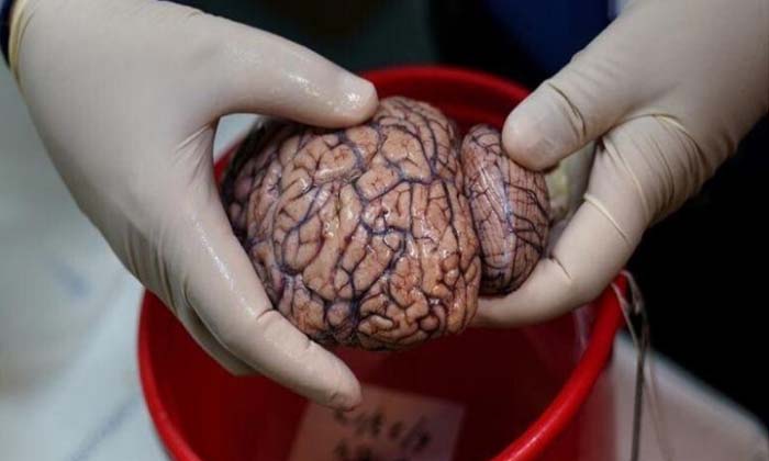  Man Arrested For Eating Woman Brain,man Beheaded, Woman Brain, Philippines, Engl-TeluguStop.com