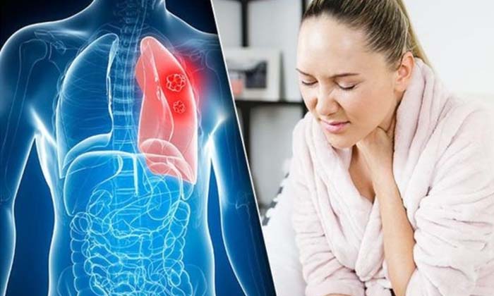  Stages Of Lung Cancer, Treatment, Covid-19-TeluguStop.com