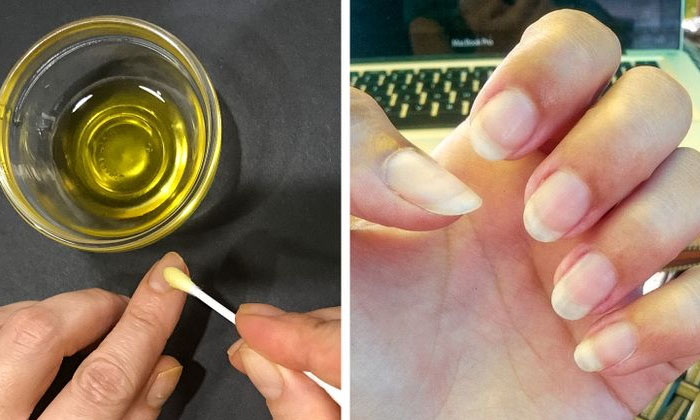  Home Remedies To Grow Nails! Home Remedies, Grow Nails, Nails, Latest News, Beau-TeluguStop.com